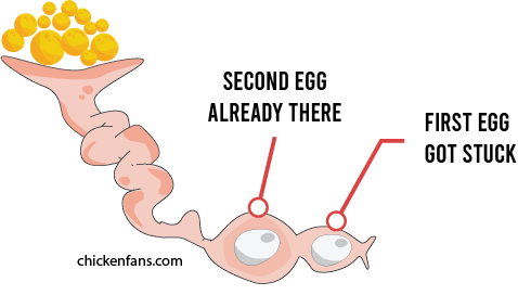 chicken laying two eggs a day with one egg stuck in the uterus and the second egg catching up