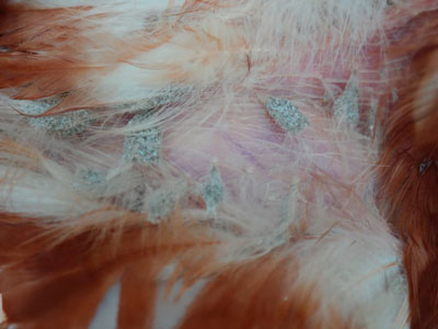 Lice infection